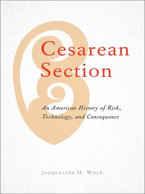 cover image of Cesarean Section
